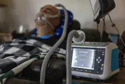 They need a ventilator to stay alive. Getting one can be a nightmare